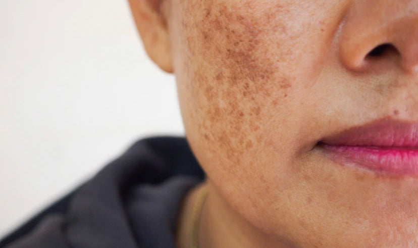 What Does Your Breakout Really Mean?