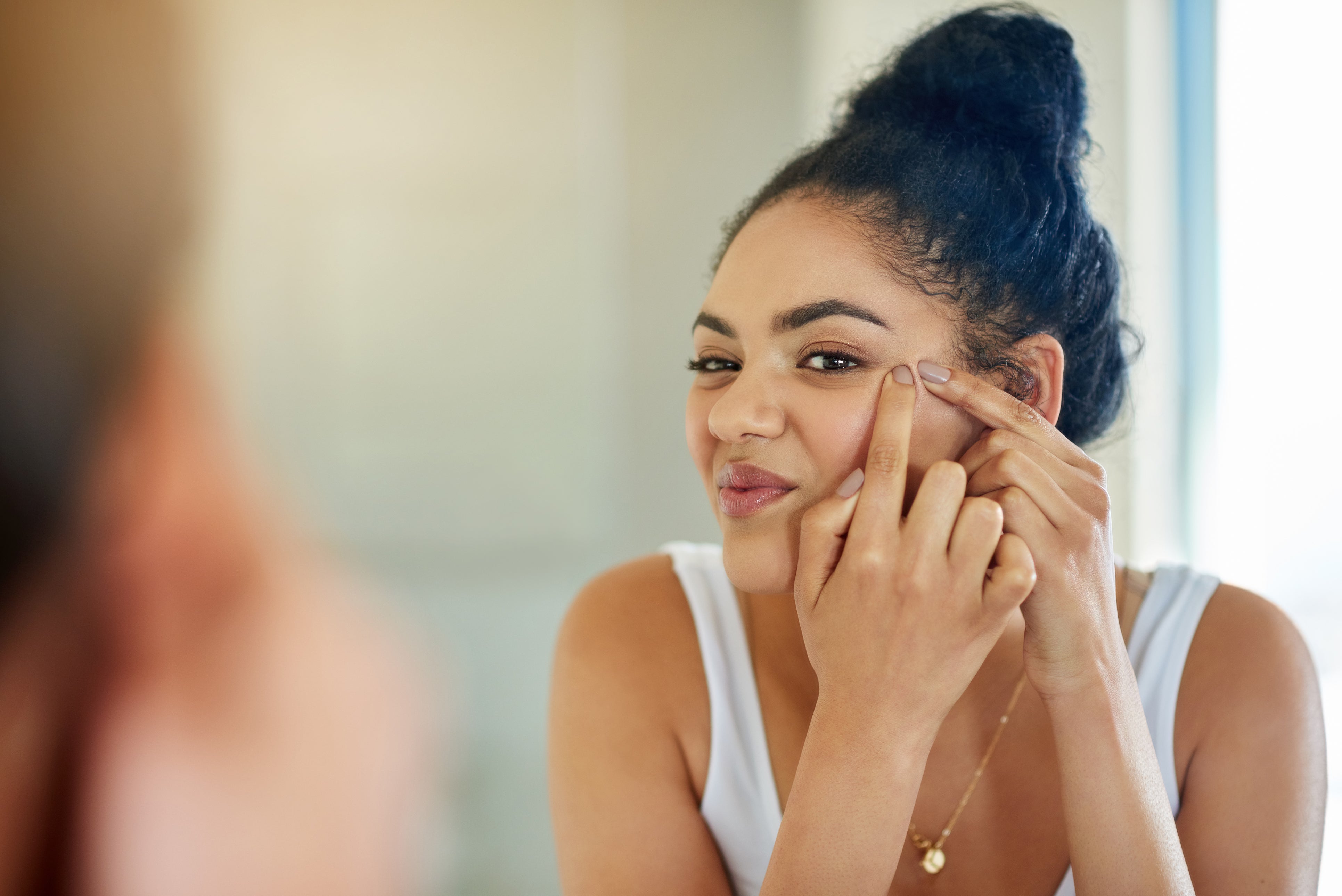 5 NEW Acne Treatment Ideas