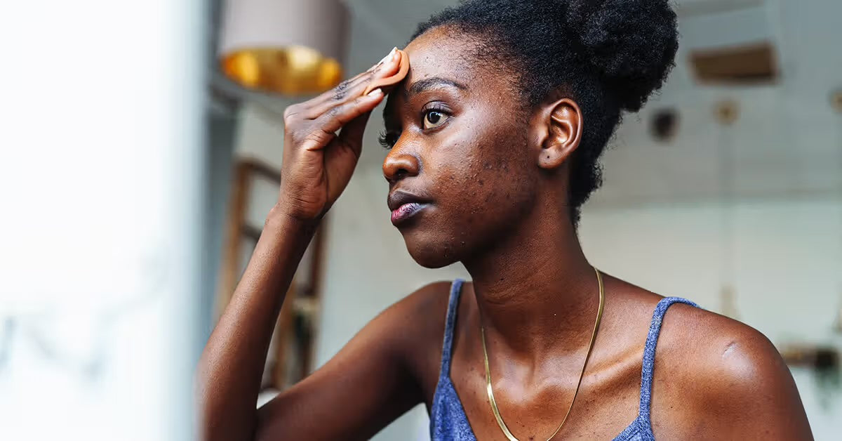 The Connection Between Mental Health, Stress-Induced Acne and The Power of Rest