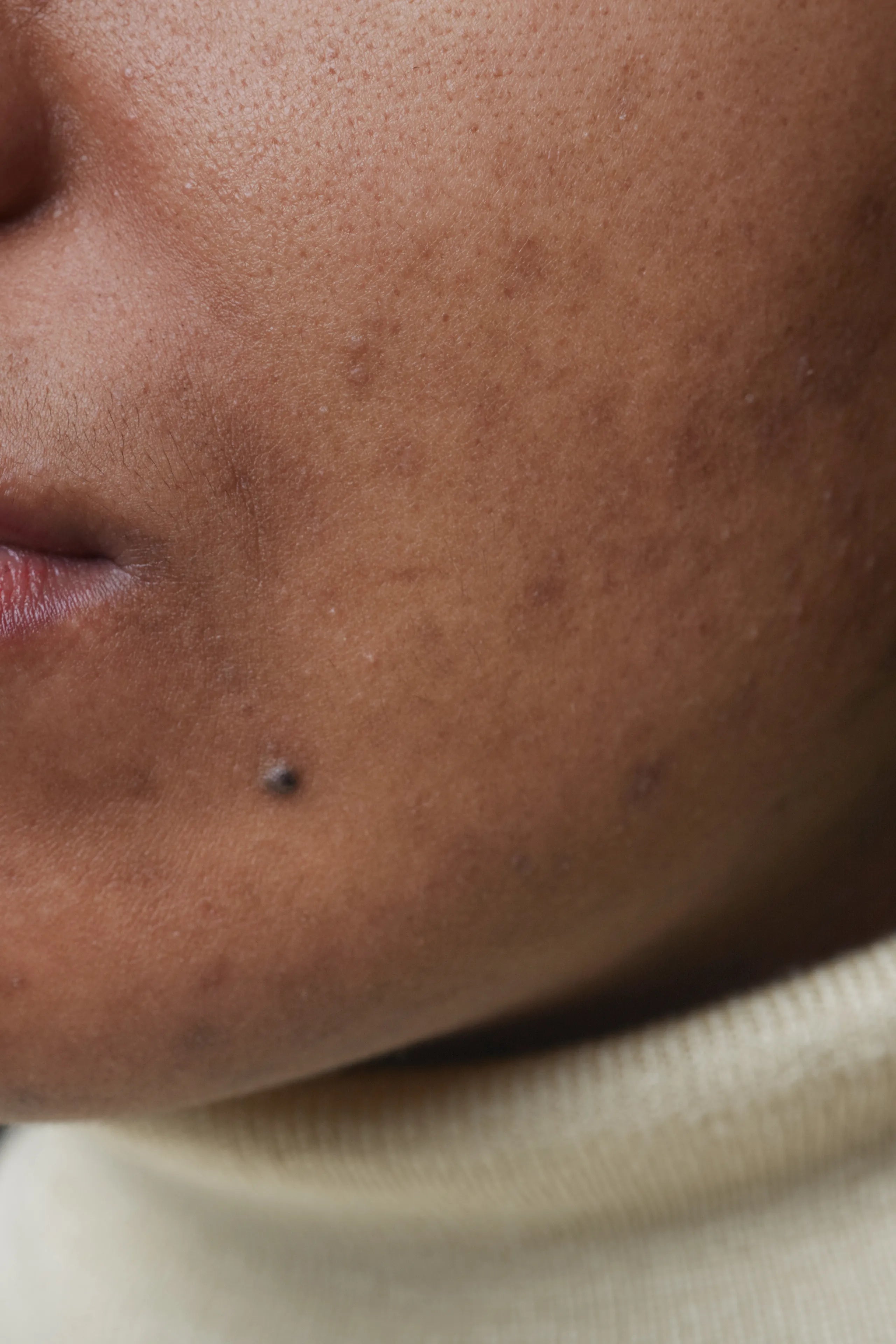 Dry Skin During Your Period? Here’s Why
