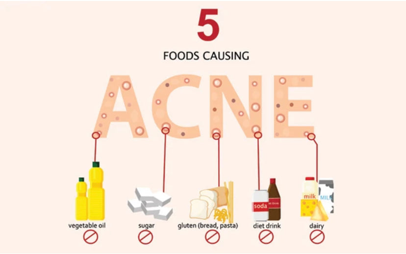 5 FOODS THAT ARE LINKED TO BREAKOUTS & SKIN DAMAGE