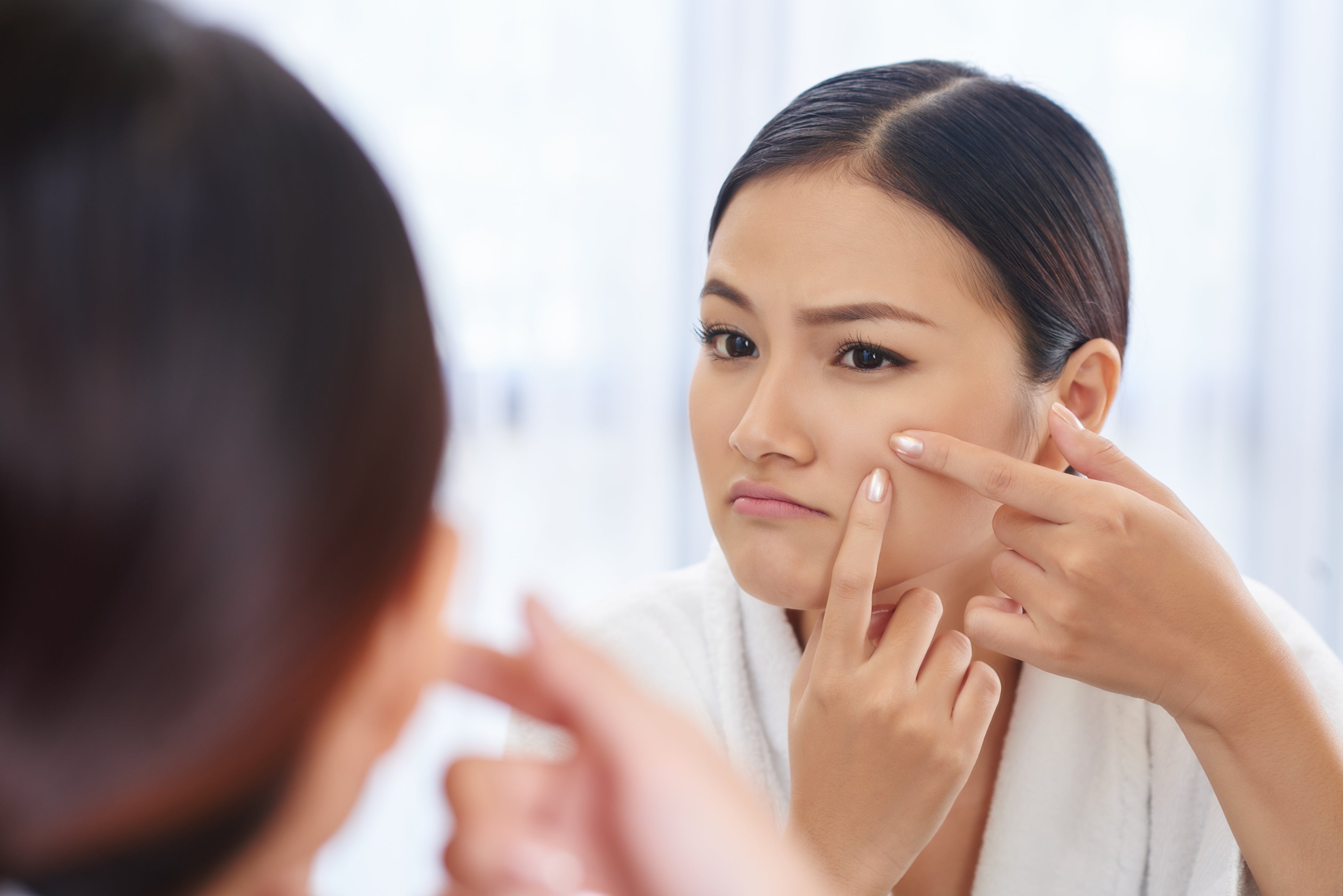 Understanding Hormonal Acne